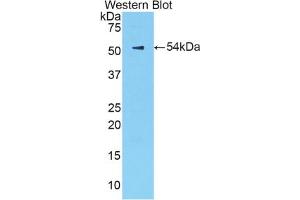Western blot analysis of the recombinant protein. (Kallikrein 6 抗体  (AA 19-261))