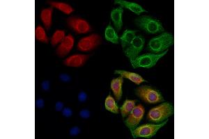 ABIN6260213 and ABIN6273093 staining Hela cells by IF/ICC. (BBS7 抗体  (Internal Region))