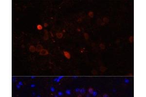 Immunofluorescence analysis of Mouse brain using CALB2 Polyclonal Antibody at dilution of 1:100. (Calretinin 抗体)