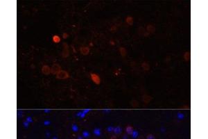 Immunofluorescence analysis of Mouse brain using CALB2 Polyclonal Antibody at dilution of 1:100. (Calretinin 抗体)