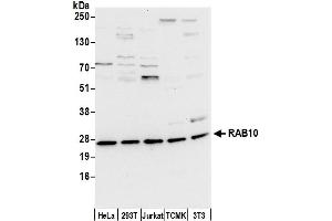 anti-RAB10, Member RAS Oncogene Family (RAB10) (AA 125-175) antibody