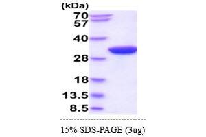 SDS-PAGE (SDS) image for Ribosomal Protein S6 Kinase, 70kDa, Polypeptide 1 (RPS6KB1) (AA 1-525) protein (His tag) (ABIN5855088) (RPS6KB1 Protein (AA 1-525) (His tag))