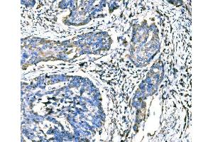 IHC analysis of ATG16L1 using anti-ATG16L1 antibody (ABIN7602244).