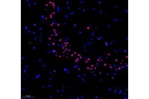 Immunofluorescence of paraffin embedded rat hippocampus using RBM8A (ABIN7075478) at dilution of 1: 300 (200x lens)
