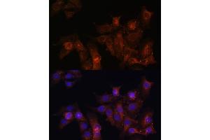 Immunohistochemistry of paraffin-embedded rat heart using Dystrophin Rabbit pAb (ABIN1679546, ABIN3015473, ABIN3015474 and ABIN6218357) at dilution of 1:25 (40x lens). (Dystrophin 抗体  (AA 346-635))