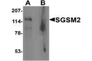 Western blot analysis of SGSM2 in human cerebellum tissue lysate with SGSM2 Antibody  at 1 μg/ml in (A) the absence and (B) the presence of blocking peptide (SGSM2 抗体  (Middle Region))