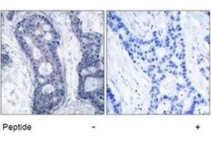 Image no. 1 for anti-Eukaryotic Translation Initiation Factor 4E (EIF4E) (Ser209) antibody (ABIN197473) (EIF4E 抗体  (Ser209))