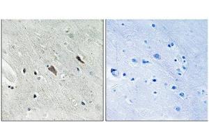 Immunohistochemical analysis of paraffin-embedded human brain tissue using Gab2 (Phospho-Tyr643) antibody (left)or the same antibody preincubated with blocking peptide (right). (GAB2 抗体  (pTyr643))