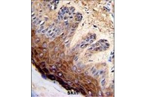 Formalin-fixed and paraffin-embedded human skin with TOP2A Antibody (C-term), which was peroxidase-conjugated to the secondary antibody, followed by DAB staining. (Topoisomerase II alpha 抗体  (C-Term))