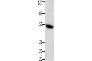 Western Blotting (WB) image for anti-Colony Stimulating Factor 2 Receptor, Alpha, Low-Affinity (Granulocyte-Macrophage) (CSF2RA) antibody (ABIN2426009) (CSF2RA 抗体)