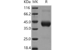 Western Blotting (WB) image for Fc Fragment of IgG, High Affinity Ia, Receptor (CD64) (FCGR1A) (Active) protein (His tag) (ABIN7195675) (FCGR1A Protein (His tag))