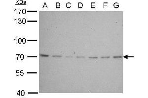 WB Image Lamin B2 antibody [N3C2], Internal detects LMNB2 protein by Western blot analysis.