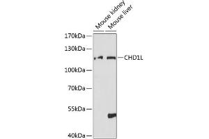 Western blot analysis of extracts of various cell lines, using CHD1L antibody (ABIN7266362) at 1:1000 dilution. (CHD1L 抗体  (AA 320-570))