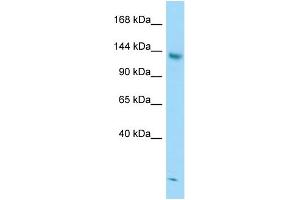 WB Suggested Anti-STAG2 Antibody Titration: 1. (STAG2 抗体  (C-Term))