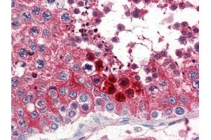 Human Testis (formalin-fixed, paraffin-embedded) stained with CLUat 2. (Clusterin 抗体  (C-Term))