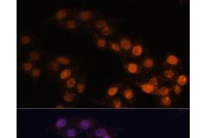 Immunofluorescence analysis of HeLa cells using WT1 Polyclonal Antibody at dilution of 1:100. (WT1 抗体)