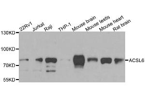 Western blot analysis of extracts of various cell lines, using ACSL6 antibody. (ACSL6 抗体  (AA 383-622))