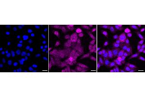 Immunocytochemical staining of HepG2 cells with PSMA3 antibody (ABIN7799967), 1:1,000).