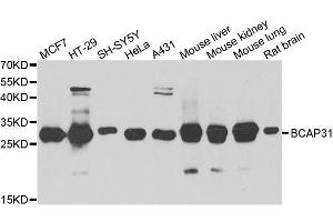 Western blot analysis of extracts of various cell lines, using BCAP31 antibody. (BCAP31 抗体  (AA 127-246))