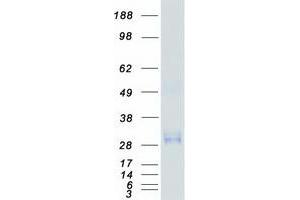 Western Blotting (WB) image for CD63 (CD63) (Transcript Variant 1) protein (Myc-DYKDDDDK Tag) (ABIN2713753)