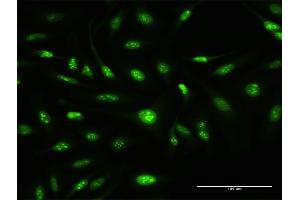 Immunofluorescence of purified MaxPab antibody to ATOH7 on HeLa cell. (ATOH7 抗体  (AA 1-152))