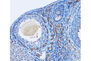 Immunohistochemistry of paraffin-embedded Rat ovary using OGDH Polyclonal Antibody at dilution of 1:100 (20x lens). (alpha KGDHC 抗体)