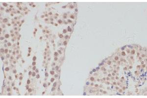 Immunohistochemistry of paraffin-embedded Mouse testis using CCNG1 Polyclonal Antibody at dilution of 1:100 (40x lens). (Cyclin G1 抗体)