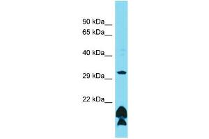 Host: Rabbit Target Name: OR51B5 Sample Type: HCT15 Whole Cell lysates Antibody Dilution: 1. (OR51B5 抗体  (C-Term))