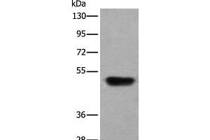 Western blot analysis of Human fetal liver tissue lysate using HNRNPH2 Polyclonal Antibody at dilution of 1:400 (HNRNPH2 抗体)