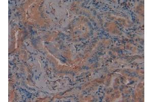 Immunohistochemistry (IHC) image for anti-Plasminogen Activator Inhibitor 1 (SERPINE1) (AA 25-402) antibody (ABIN1078449)
