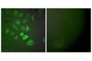 Immunofluorescence analysis of A549 cells, using S100 A1 antibody. (S1A1 抗体)