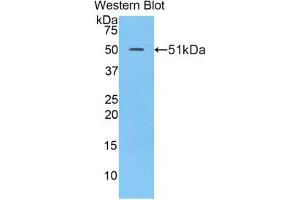 Western blot analysis of the recombinant protein. (LAMC2 抗体  (AA 972-1191))