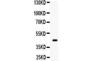 Western Blotting (WB) image for anti-Wingless-Type MMTV Integration Site Family, Member 2B (WNT2B) (AA 87-112), (N-Term) antibody (ABIN3042337)