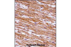 Immunohistochemistry (Paraffin-embedded Sections) (IHC (p)) image for anti-NIMA (Never in Mitosis Gene A)-Related Kinase 6 (NEK6) (AA 251-280), (C-Term) antibody (ABIN657847)