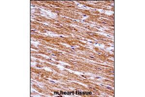 Mouse Nek6 Antibody (C-term) ((ABIN657847 and ABIN2846808))immunohistochemistry analysis in formalin fixed and paraffin embedded mouse heart tissue followed by peroxidase conjugation of the secondary antibody and DAB staining. (NEK6 抗体  (C-Term))