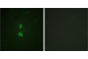 Immunofluorescence analysis of HuvEc cells, using SNAI1 (Phospho-Ser246) Antibody.