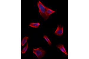 ABIN6261694 and ABIN6273243 staining Hela by IF/ICC. (FBXO22 抗体  (Internal Region))
