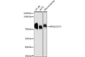 Western Blotting (WB) image for anti-5'-Nucleotidase, Ecto (CD73) (NT5E) (AA 290-550) antibody (ABIN3022734)
