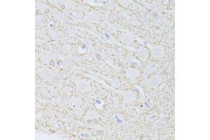 Immunohistochemistry of paraffin-embedded rat brain using PHGDH antibody (ABIN5998506) at dilution of 1/100 (40x lens). (PHGDH 抗体)