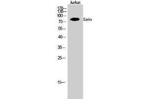 Western Blotting (WB) image for anti-Ezrin (EZR) (Tyr315) antibody (ABIN3184570) (Ezrin 抗体  (Tyr315))
