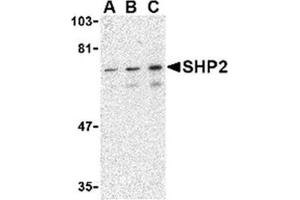 Image no. 1 for anti-Protein tyrosine Phosphatase, Non-Receptor Type 11 (PTPN11) (C-Term) antibody (ABIN318781) (PTPN11 抗体  (C-Term))