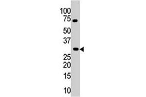 The PIM3 polyclonal antibody  is used in Western blot to detect PIM3 in mouse kidney tissue lysate. (PIM3 抗体  (C-Term))