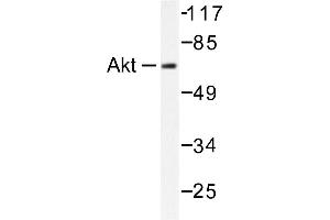 Image no. 1 for anti-V-Akt Murine Thymoma Viral Oncogene Homolog 1 (AKT1) antibody (ABIN265302) (AKT1 抗体)