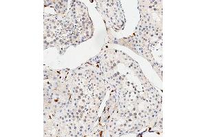Immunohistochemistry (Paraffin-embedded Sections) (IHC (p)) image for anti-Collagen, Type VIII, alpha 2 (COL8A2) (AA 571-599), (C-Term) antibody (ABIN655804)