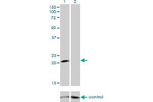 Western blot analysis of GUCA1A over-expressed 293 cell line, cotransfected with GUCA1A Validated Chimera RNAi (Lane 2) or non-transfected control (Lane 1).