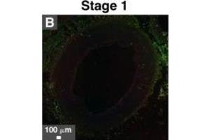 Immunohistological staining of artery tissues from diabetic subjects showing colocalization of serum proteins and mineral deposits.