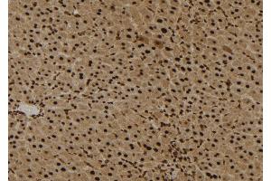 ABIN6272294 at 1/100 staining Mouse liver tissue by IHC-P. (EPS8-Like 3 抗体)