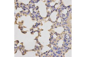 Immunohistochemistry of paraffin-embedded mouse lung using PRKACB antibody (ABIN5973065) at dilution of 1/200 (40x lens). (PRKACB 抗体)