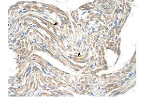 CKMT2 antibody was used for immunohistochemistry at a concentration of 4-8 ug/ml to stain Skeletal muscle cells (arrows) in Human Muscle. (CKMT2 抗体)