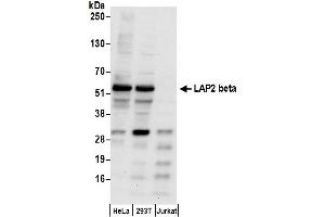 Western Blotting (WB) image for anti-LAP2 beta gamma/tmpo (AA 350-400) antibody (ABIN7455057) (LAP2 beta gamma/tmpo (AA 350-400) 抗体)